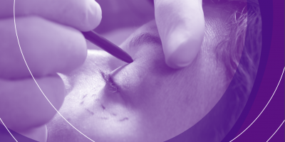 Easy Read: Cosmetic Procedures